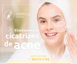3081776 1 acne.png 3081776 1 acne.png